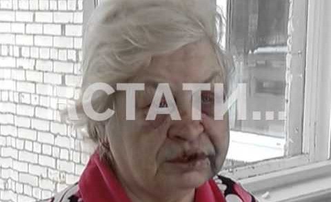 Травмы, несовместимые с возрастом — 64-летняя пенсионерка стала жертвой жестокого нападения