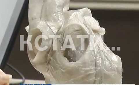 Пластиковая копия человеческого сердца спасает нижегородских хирургов от врачебных ошибок