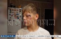 Мужчина вмешался в конфликт 10-летних детей, стал душить и бить ребёнка головой об асфальт