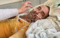 Слесарь во время ремонта получил 70% ожогов тела, и родные боятся, что во всём обвинят его самого