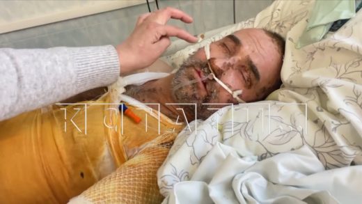 Слесарь во время ремонта получил 70% ожогов тела, и родные боятся, что во всём обвинят его самого