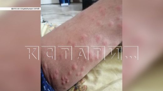 Черви церкарии нападают в воде на купающихся в озёрах Нижнего Новгорода