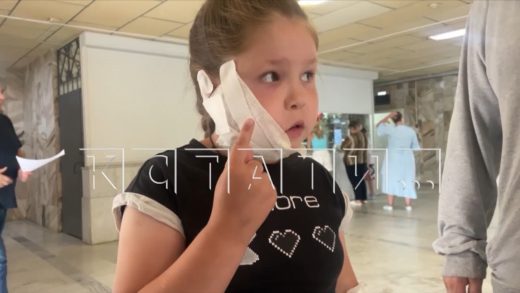 Бойцовская собака при своей хозяйке напала и изуродовала 9 летнюю девочку