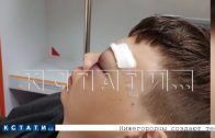 Ученика в школе избили так, что он оказался в больнице с множественными переломами костей лица