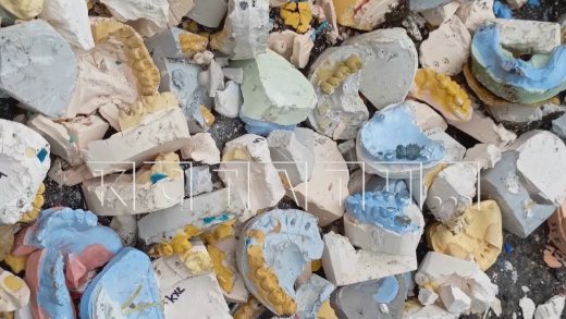 Ямочный ремонт асфальтовой дороги выполнили с помощью зубных слепков