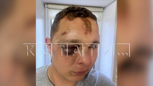 Посетитель концерта обвиняет ЧОПовцев в зверском избиении, они его — в потребительском экстремизме