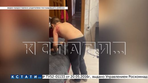 Сорвавшийся с цепи пёс напал на улице на ребёнка, но на защиту мальчика бросилась соседская собака