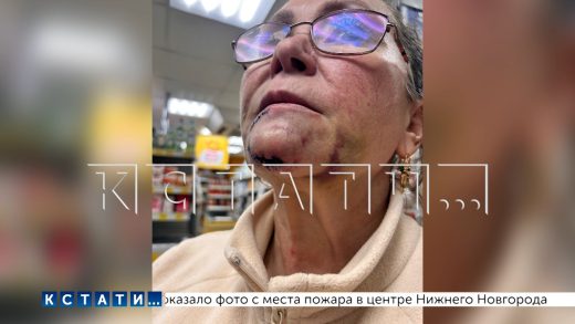 Женщина изуродовала лицо из‑за нечищеных платформ ГЖД,а платформы не чистят из‑за обмана с зарплатой