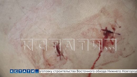 Бывший муж, преследовавший бывшую жену, пообещал на видео зарезать её чужими руками, исполнил угрозу