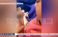 Трёхлетней девочке оторвало палец в детсаду, когда она от страха спряталась от воспитательницы в ящи