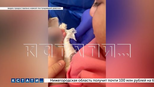 Трёхлетней девочке оторвало палец в детсаду, когда она от страха спряталась от воспитательницы в ящи