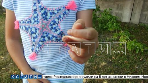 В игровой комнате ресторана восьмилетней девочке ампутировало палец