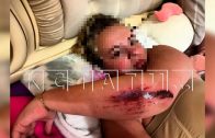Посетительница конного клуба пытается взыскать с клуба деньги за якобы случившийся перелом Посетительница конного клуба пытается взыскать с клуба деньги за якобы случившийся перелом