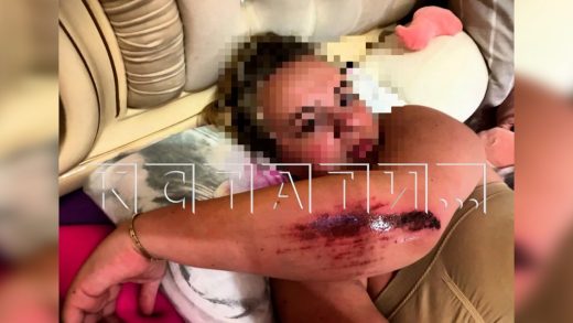 Посетительница конного клуба пытается взыскать с клуба деньги за якобы случившийся перелом
