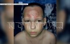 15‑летняя девочка душила 11‑летнего мальчика, а потом с проломленным черепом дети его бросили одного