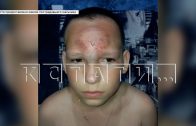 15‑летняя девочка душила 11‑летнего мальчика, а потом с проломленным черепом дети его бросили одного