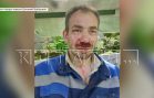 Бизнесмен, решивший построить новый бизнес в городском СНТ, бьёт садоводов и ломает им носы