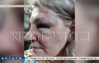 Жена, которую бросил муж ради любовницы, выдала его коллекторам, а он попытался откусить ей руку